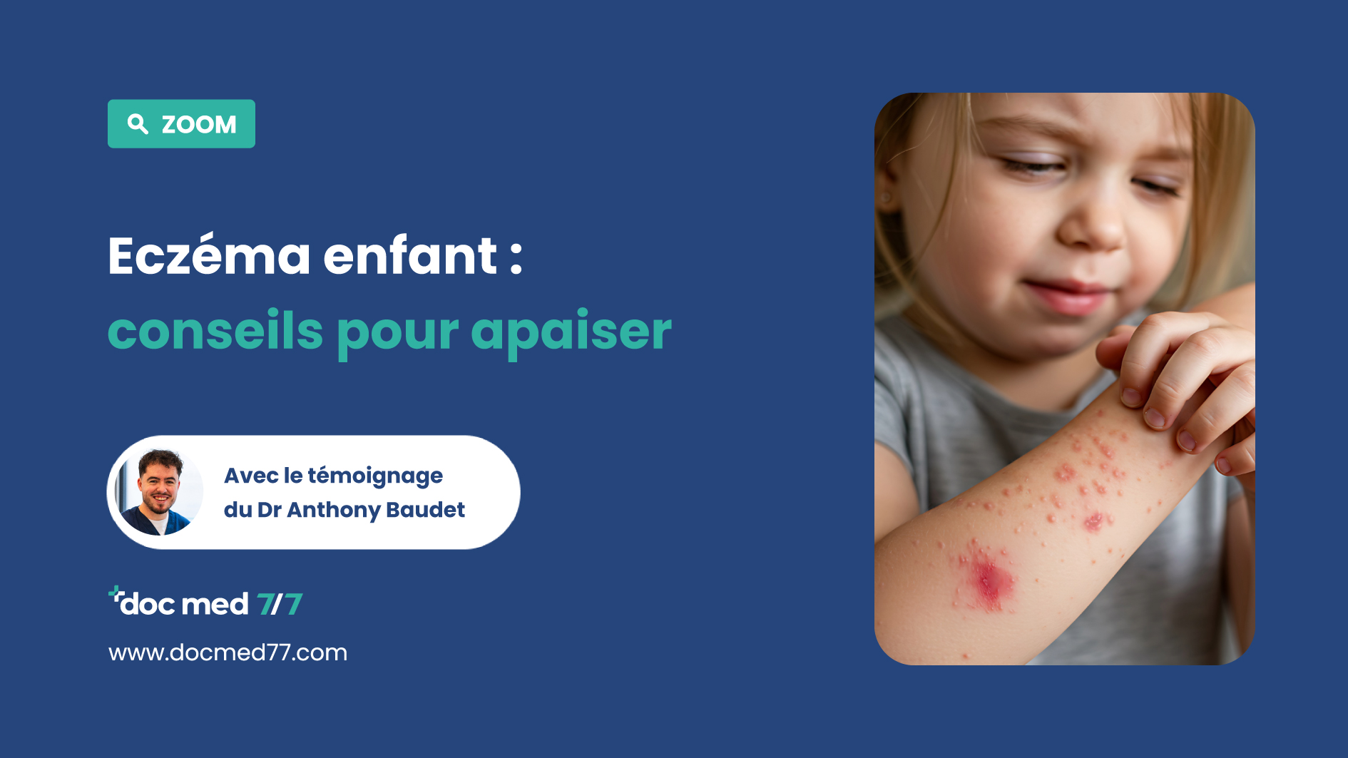 Eczéma chez l&rsquo;enfant : Conseils pour a . . .